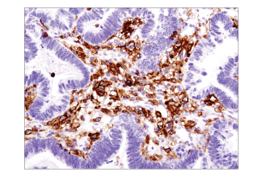 CD45 (Intracellular Domain) (D9M8I) XP® Rabbit mAb (BSA and