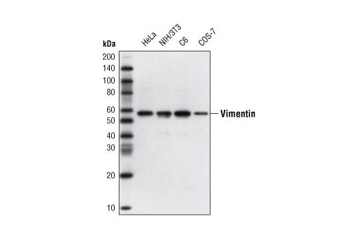 Western Blotting Image 2: Vimentin (D21H3) Rabbit Monoclonal Antibody