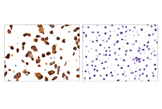 Immunohistochemistry Image 2: p130 Cas (E1L9H) Rabbit Monoclonal Antibody (BSA and Azide Free)