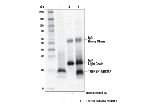 Immunoprecipitation Image 1: TNFRSF17/BCMA Antibody