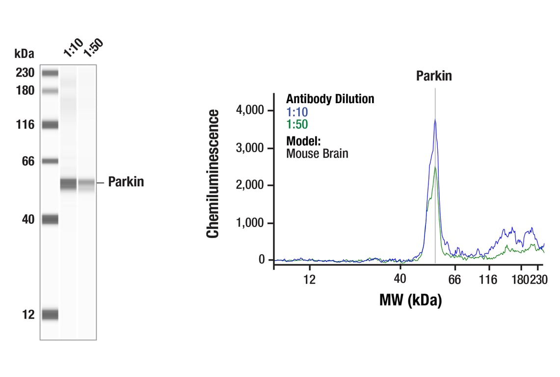 Western Blotting Image 1: Parkin (E6B1P) Mouse Monoclonal Antibody