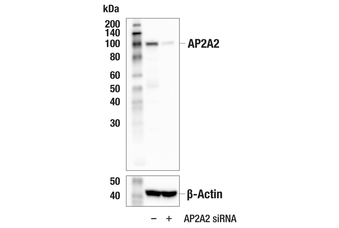 Western Blotting Image 3: AP2A2 (E9Q1O) Rabbit Monoclonal Antibody