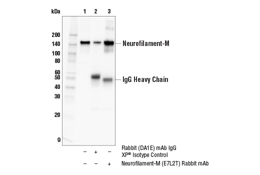 Immunoprecipitation Image 1: Neurofilament-M (E7L2T) Rabbit Monoclonal Antibody