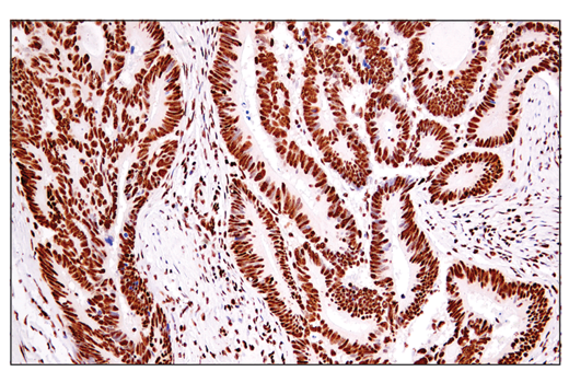 Immunohistochemistry Image 2: ADAR1 (E6X9R) Rabbit Monoclonal Antibody (BSA and Azide Free)