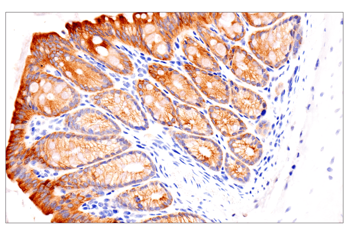 Immunohistochemistry Image 15: Pan-Keratin (Type II) (F6G1P) Rabbit Monoclonal Antibody
