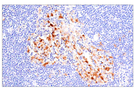 Immunohistochemistry Image 2: Factor XIIIA (E980.1) Mouse Monoclonal Antibody