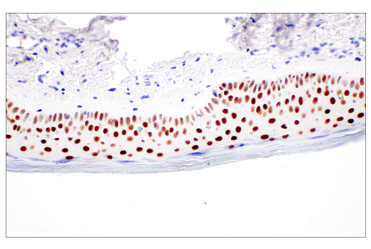 Immunohistochemistry Image 5: POU2F3 (E5N2D) Rabbit Monoclonal Antibody