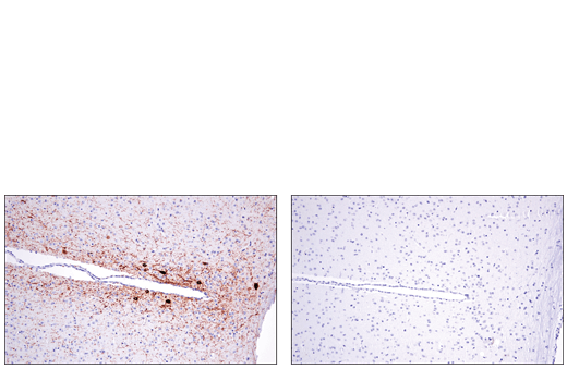 Immunohistochemistry Image 1: Tyrosine Hydroxylase (E2L6M) Rabbit Monoclonal Antibody (BSA and Azide Free)