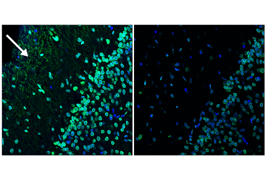 Immunofluorescence Image 3: TrueBlack<sup>®</sup> Lipofuscin Autofluorescence Quencher