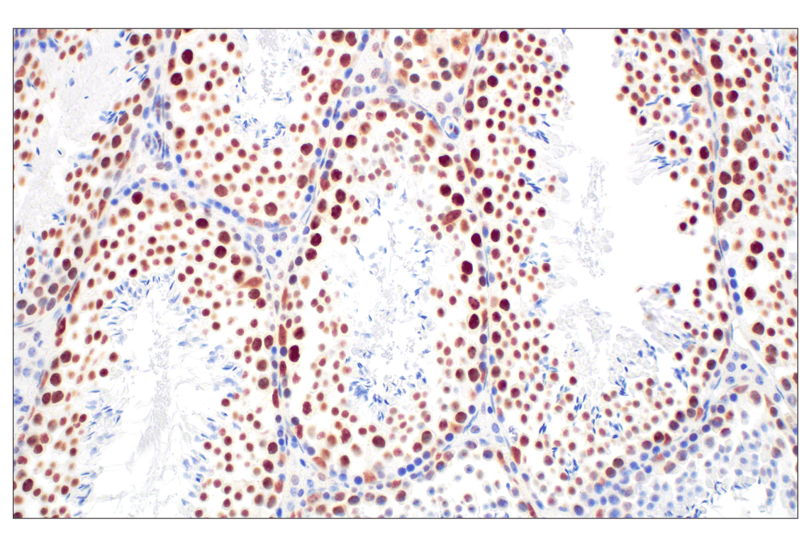 Immunohistochemistry Image 14: CBX7 (E7N1W) Rabbit Monoclonal Antibody