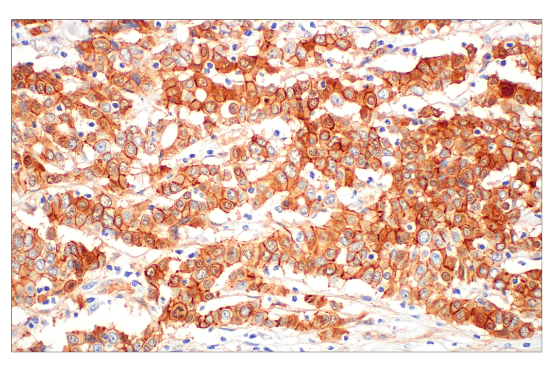 Immunohistochemistry Image 1: beta-Catenin (D10A8) Rabbit Monoclonal Antibody