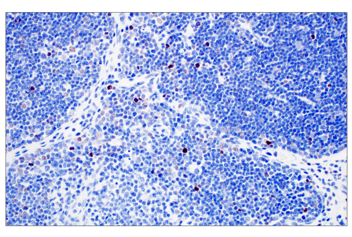 Immunohistochemistry Image 5: Phospho-Histone H3 (Ser10) (D7N8E) Rabbit Monoclonal Antibody (BSA and Azide Free)