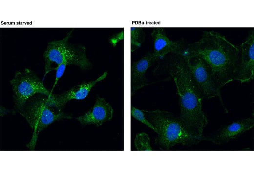 Immunofluorescence Image 1: PKD2 (D1A7) Rabbit Monoclonal Antibody