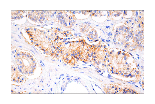 Immunohistochemistry Image 3: HER2/ErbB2 (D8F12) Rabbit Monoclonal Antibody (BSA and Azide Free)