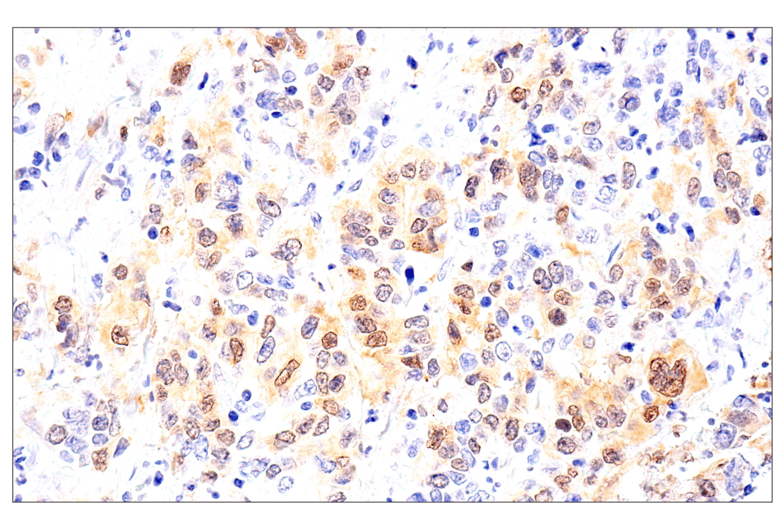 Immunohistochemistry Image 7: Chk1 (2G1D5) Mouse Monoclonal Antibody (BSA and Azide Free)