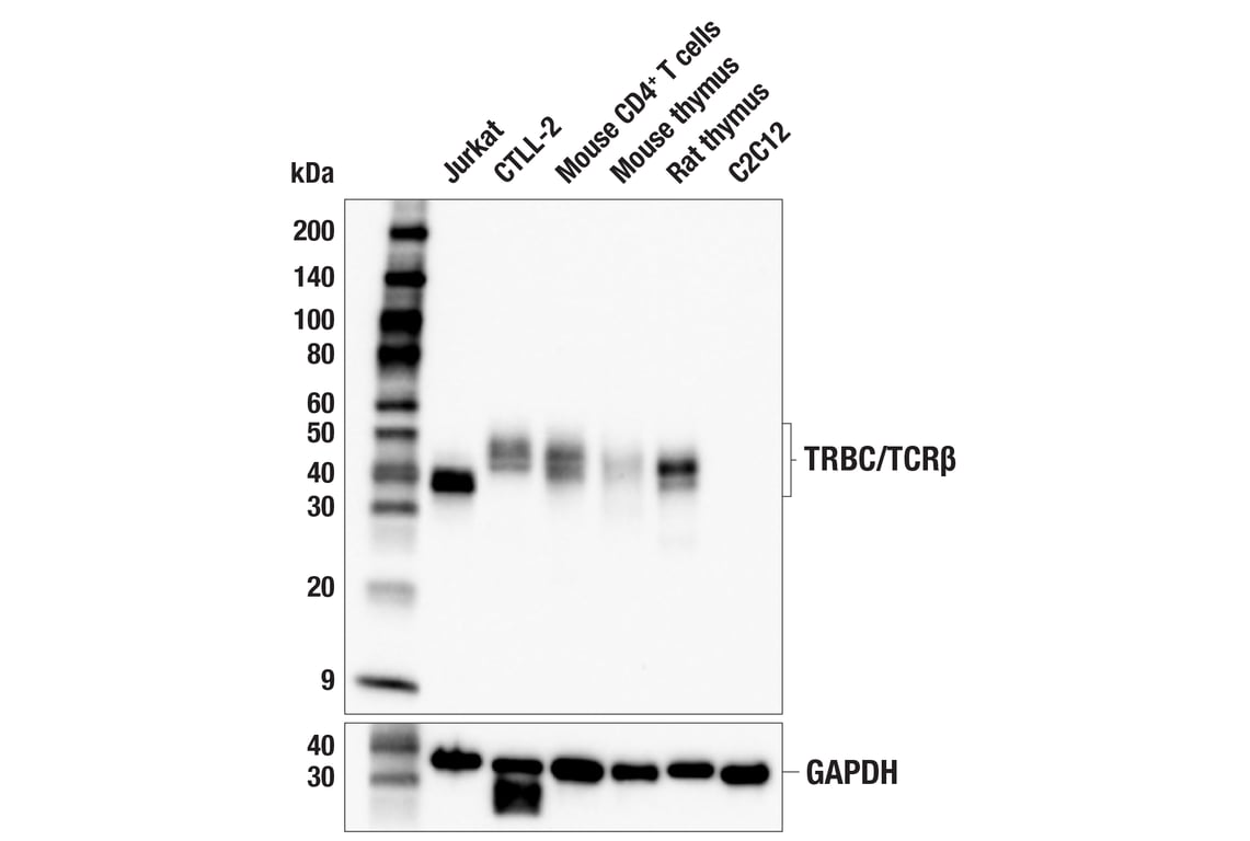 Western Blotting Image 2: TRBC/TCR beta (E9I1S) Rabbit Monoclonal Antibody