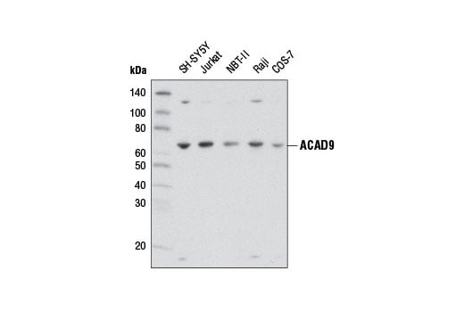 Western Blotting Image 1: ACAD9 Antibody