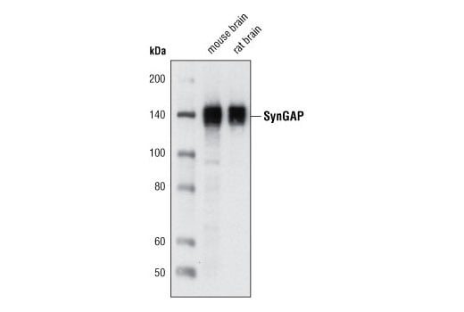 Western Blotting Image 1: SynGAP (D20C7) Rabbit mAb