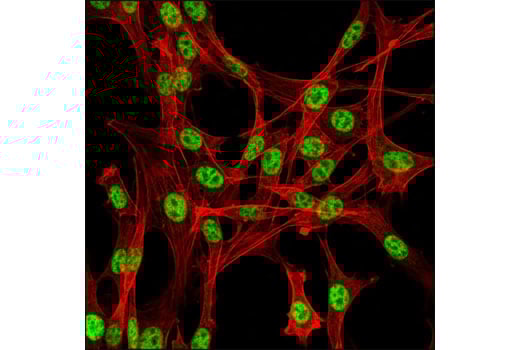 Immunofluorescence Image 1: IWS1 Antibody