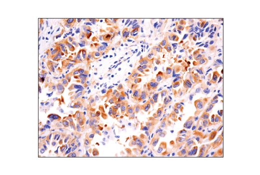 Immunohistochemistry Image 2: FAK (D5O7U) Rabbit Monoclonal Antibody