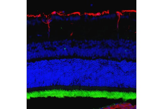 Immunofluorescence Image 1: Rhodopsin (D4B9B) Rabbit Monoclonal Antibody