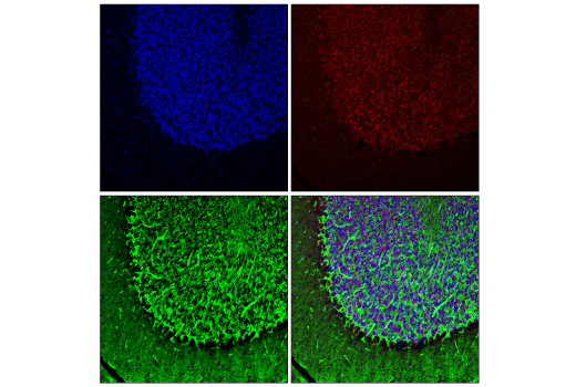 Immunofluorescence Image 1: EGR1 (15F7) Rabbit Monoclonal Antibody
