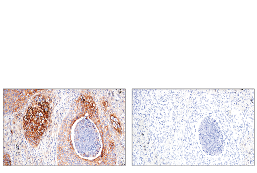 Immunohistochemistry Image 7: CD54/ICAM-1 (E3Q9N) XP<sup>®</sup> Rabbit mAb