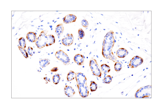 Immunohistochemistry Image 2: S100A1 (4C4.9) Mouse Monoclonal Antibody