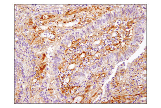 Immunohistochemistry Image 1: B7-H3 (D9M2L) Rabbit Monoclonal Antibody (BSA and Azide Free)