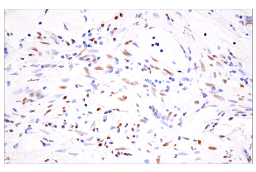 Immunohistochemistry Image 6: CPSF4 (E2L2Z) Rabbit Monoclonal Antibody