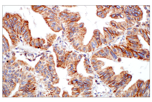 Immunohistochemistry Image 1: DHFR (E6L1H) Rabbit Monoclonal Antibody