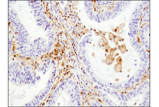 Immunohistochemistry Image 2: Stat5 (D3N2B) Rabbit Monoclonal Antibody (BSA and Azide Free)
