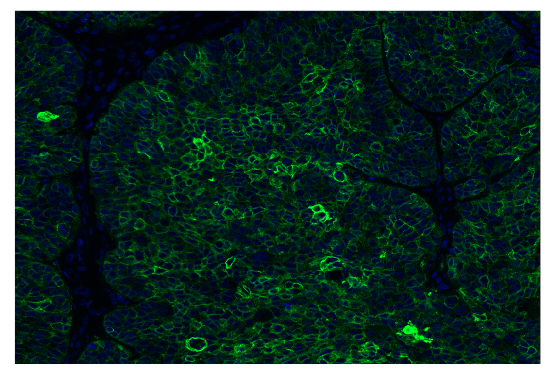 Immunohistochemistry Image 1: TACSTD2/TROP2 (F4W4J) & CO-0150-488 SignalStar<sup>™</sup> Oligo-Antibody Pair
