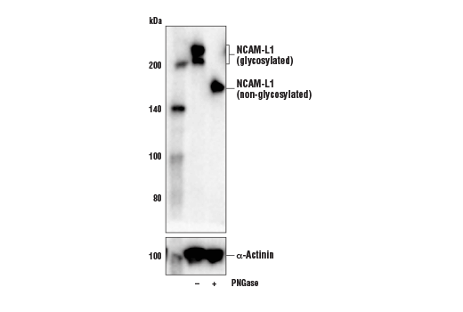 Western Blotting Image 2: NCAM-L1 (D5N9S) Rabbit Monoclonal Antibody