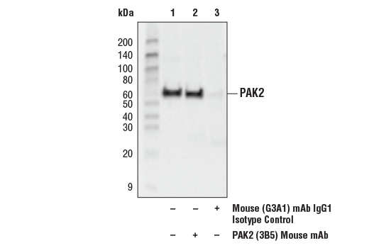 Immunoprecipitation Image 1: PAK2 (3B5) Mouse Monoclonal Antibody