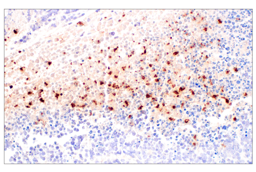 Immunohistochemistry Image 4: Neutrophil Elastase (E8U3X) Rabbit Monoclonal Antibody