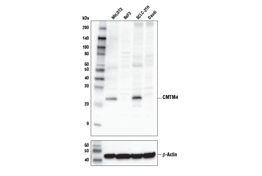 Western Blotting Image 1: CMTM4 Antibody