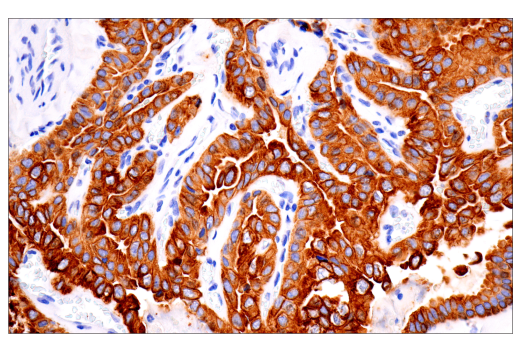 Immunohistochemistry Image 2: Keratin 7 (RN7) Mouse Monoclonal Antibody