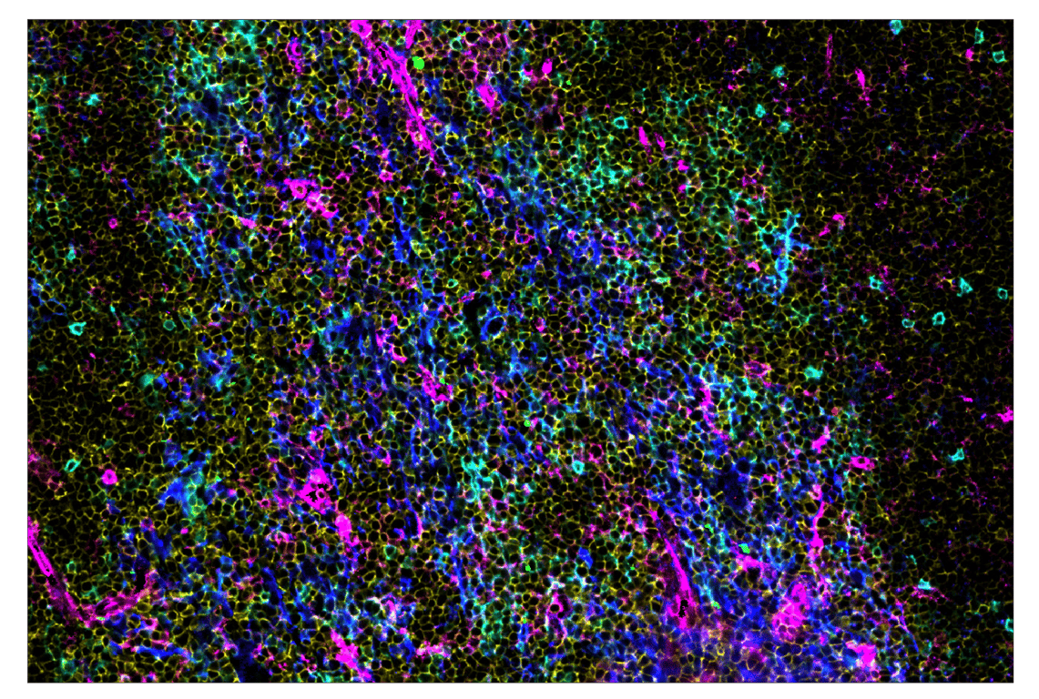 Immunohistochemistry Image 7: CD39/NTPDase 1 (E2X6B) & CO-0076-594 SignalStar<sup>™</sup> Oligo-Antibody Pair