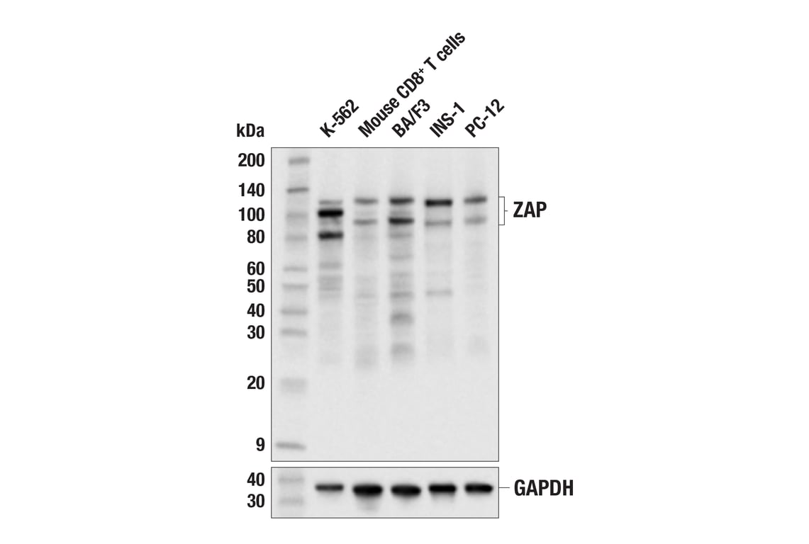 Western Blotting Image 2: ZAP (E5V4D) Rabbit Monoclonal Antibody