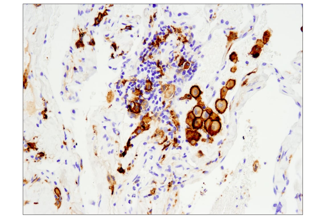 Immunohistochemistry Image 1: CD163 (D6U1J) Rabbit Monoclonal Antibody (BSA and Azide Free)