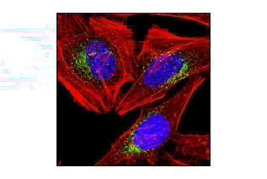 undefined Image 11: Organelle Localization IF Antibody Sampler Kit