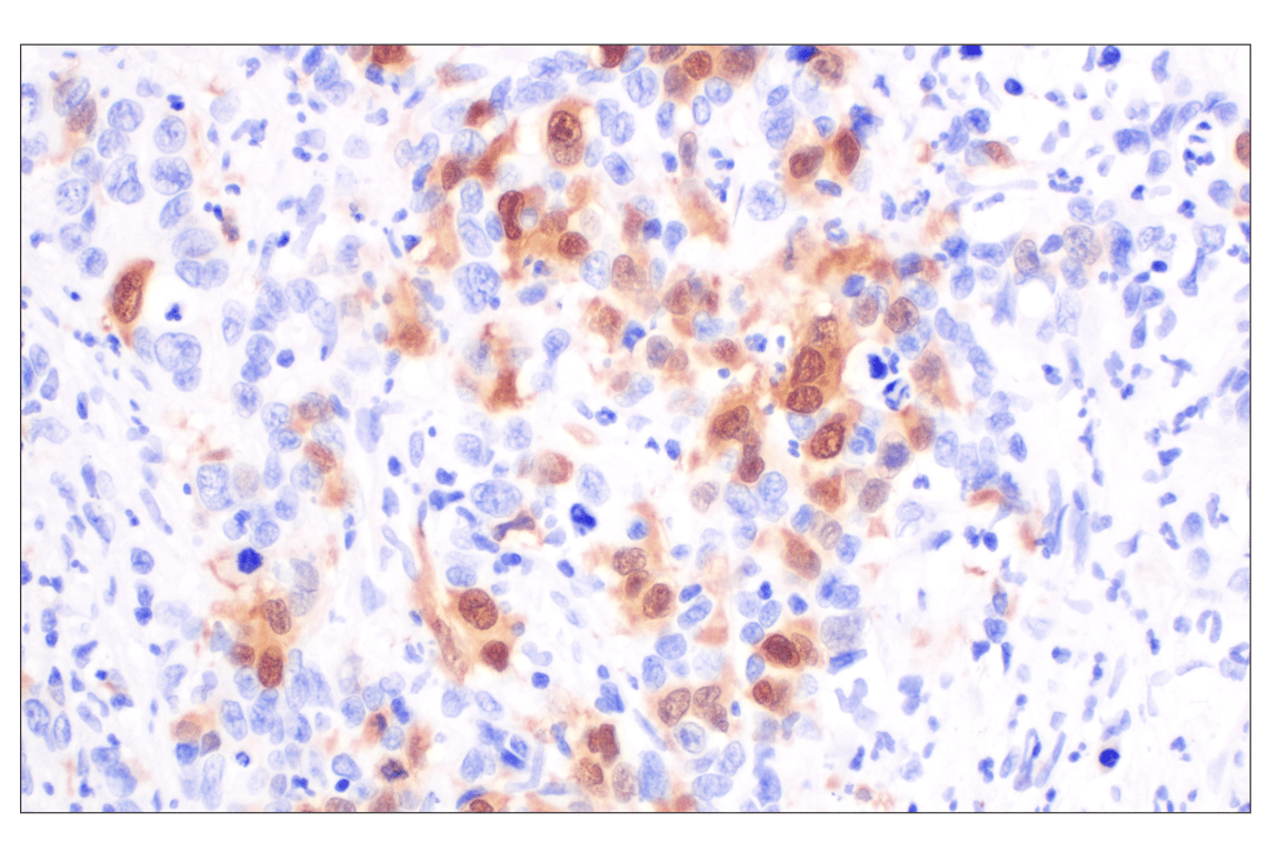 Immunohistochemistry Image 2: Thymidine Kinase 1 (E2H7Z) Rabbit Monoclonal Antibody