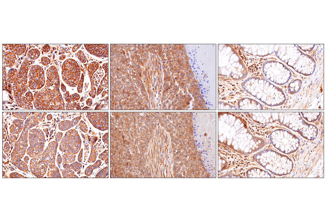 Immunohistochemistry Image 3: NF-kappaB p65 (D14E12) Rabbit Monoclonal Antibody (BSA and Azide Free)