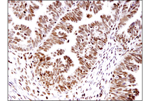 Immunohistochemistry Image 1: ANP32A (D7Z5U) Rabbit Monoclonal Antibody