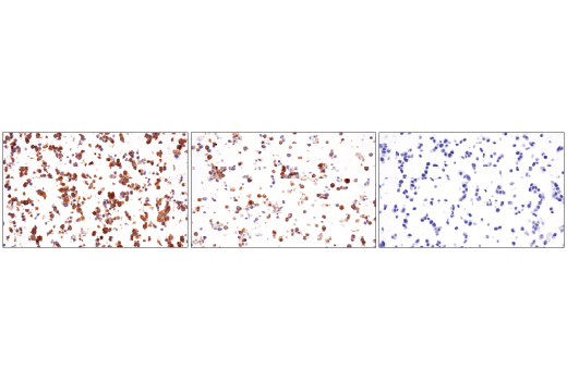 Immunohistochemistry Image 2: DLL3 (E3J5R) Rabbit mAb