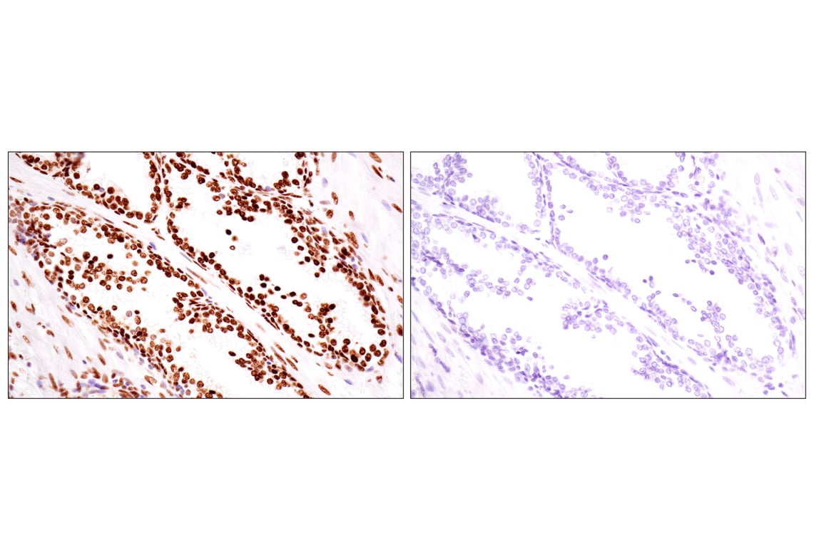 Immunohistochemistry Image 9: ILF3 (E5H6F) Rabbit Monoclonal Antibody