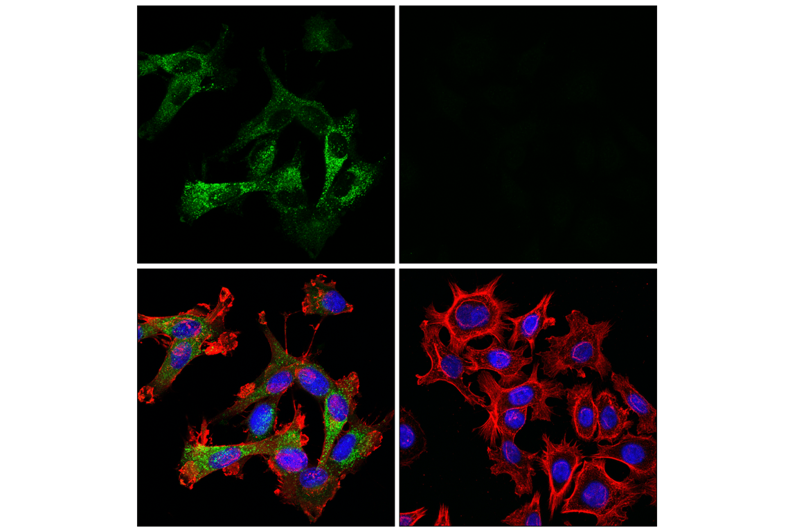 Immunofluorescence Image 2: Cathepsin L (E3R3P) Rabbit mAb