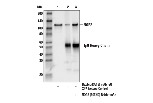 Immunoprecipitation Image 1: NOP2 (E9Z4D) Rabbit Monoclonal Antibody