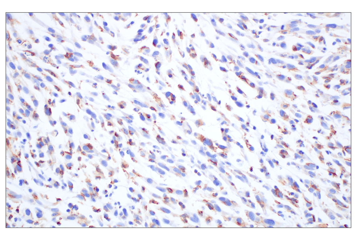 Immunohistochemistry Image 2: Siglec-1/CD169 (E1D7G) Rabbit Monoclonal Antibody (BSA and Azide Free)